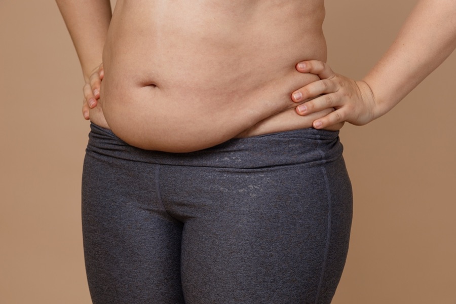 Mulher com a região abdominal sem firmeza